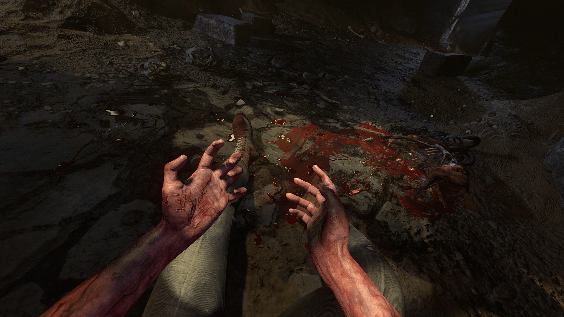 Infection